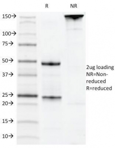 CD22 Antibody - SDS-PAGE Analysis of Purified, BSA-Free CD22 Antibody (clone MYG13). Confirmation of Integrity and Purity of the Antibody.
