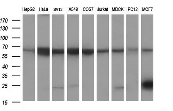 CD22 Antibody - Western blot of extracts (35ug) from 9 different cell lines by using anti-CD22 monoclonal antibody (HepG2: human; HeLa: human; SVT2: mouse; A549: human; COS7: monkey; Jurkat: human; MDCK: canine; PC12: rat; MCF7: human).