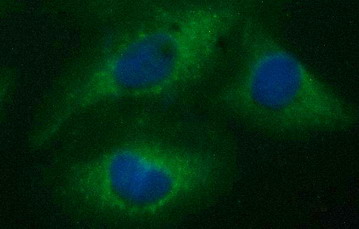 CD22 Antibody - Immunofluorescent staining of HeLa cells using anti-CD22 mouse monoclonal antibody.