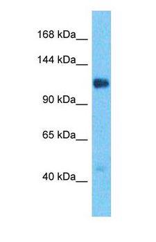 CD22 Antibody - Western blot of CD22 Antibody with human Fetal Lung lysate.  This image was taken for the unconjugated form of this product. Other forms have not been tested.