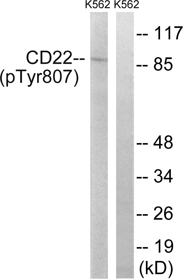 CD22 Antibody - Western blot analysis of lysates from K562 cells treated with Na3VO4 0.3nM 40', using BL-CAM (Phospho-Tyr807) Antibody. The lane on the right is blocked with the phospho peptide.