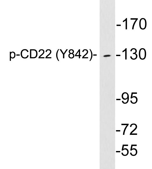 CD22 Antibody - Western blot analysis of lysates from K562 cells treated with Na3VO4, using p-CD22 (Phospho-Tyr842) antibody.