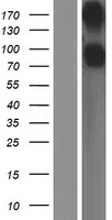 CD22 Protein - Western validation with an anti-DDK antibody * L: Control HEK293 lysate R: Over-expression lysate