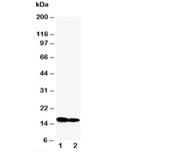 CD225 / IFITM1 Antibody - Western blot testing of IFITM1 antibody and Lane 1: SW620; 2: CEM cell lysate