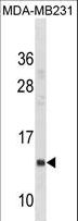 CD225 / IFITM1 Antibody - IFITM1 Antibody western blot of MDA-MB231 cell line lysates (35 ug/lane). The IFITM1 antibody detected the IFITM1 protein (arrow).