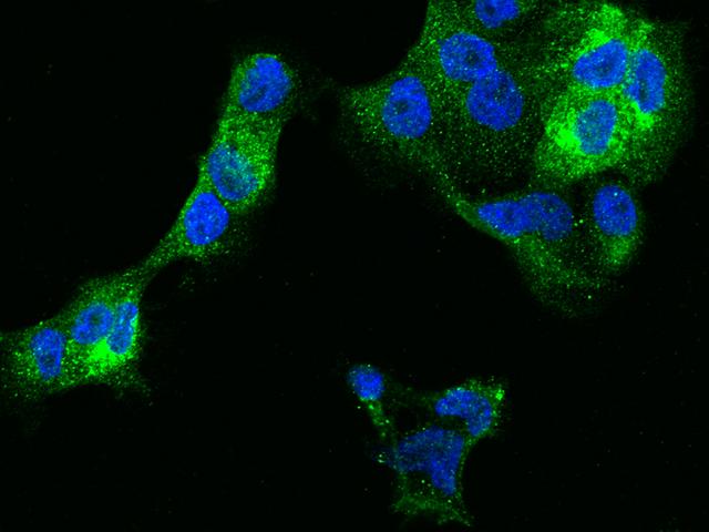 CD225 / IFITM1 Antibody - Immunofluorescence staining of IFITM1 in A431 cells. Cells were fixed with 4% PFA, permeabilzed with 0.1% Triton X-100 in PBS, blocked with 10% serum, and incubated with rabbit anti-human IFITM1 monoclonal antibody (dilution ratio 1:60) at 4°C overnight. Then cells were stained with the Alexa Fluor 488-conjugated Goat Anti-rabbit IgG secondary antibody (green) and counterstained with DAPI (blue). Positive staining was localized to Cytoplasm.
