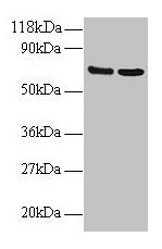 CD225 / IFITM1 Antibody - Western blot All lanes: Interferon-induced transmembrane protein 1 antibody at 2µg/ml Lane 1: EC109 whole cell lysate Lane 2: 293T whole cell lysate Secondary Goat polyclonal to rabbit IgG at 1/15000 dilution Predicted band size: 14 kDa Observed band size: 70 kDa
