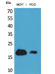 CD225 / IFITM1 Antibody - Western Blot analysis of extracts from MCF7, PC12 cells using IFITM1 Antibody.