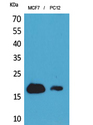 CD225 / IFITM1 Antibody - Western Blot analysis of extracts from MCF7, PC12 cells using IFITM1 Antibody.