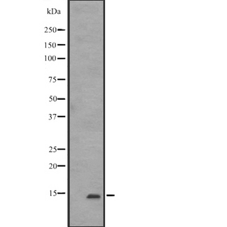 CD225 / IFITM1 Antibody - Western blot analysis of IFITM1 expression in K562. The lane on the left is treated with the antigen-specific peptide.