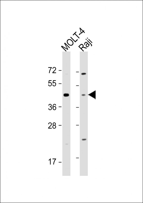 CD24 Antibody - All lanes: Anti-CD24 Antibody (Center) at 1:1000-1:2000 dilution Lane 1: MOLT-4 whole cell lysate Lane 2: Raji whole cell lysate Lysates/proteins at 20 µg per lane. Secondary Goat Anti-Rabbit IgG, (H+L), Peroxidase conjugated at 1/10000 dilution. Predicted band size: 8 kDa Blocking/Dilution buffer: 5% NFDM/TBST.