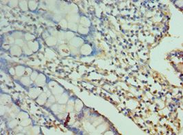 CD244 Antibody - Immunohistochemistry of paraffin-embedded human small intestine using antibody at 1:100 dilution.