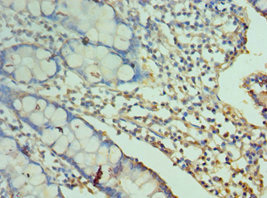 CD244 Antibody - Immunohistochemistry of paraffin-embedded human small intestine tissue using CD244 Antibody at dilution of 1:100