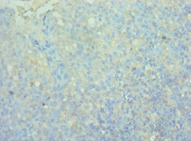 CD244 Antibody - Immunohistochemistry of paraffin-embedded human tonsil tissue using CD244 Antibody at dilution of 1:100