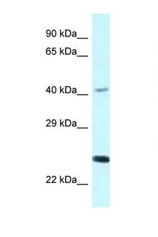 CD244 Antibody - CD244 antibody Western blot of COL0205 Cell lysate. Antibody concentration 1 ug/ml.  This image was taken for the unconjugated form of this product. Other forms have not been tested.