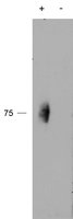 CD244 Antibody - CD244 antibody (2 ug/ml) staining of IP from a lysate of Human Natural Killer cells with (+) or without (-) pervanadate treatment of the cells. Primary incubation was 1 hour. Detected by chemiluminescence.
