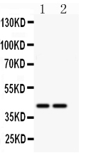 CD244 Antibody - anti-CD244 antibody, Western blotting All lanes: Anti CD244 at 0.5ug/ml Lane 1: MCF-7 Whole Cell Lysate at 40ugLane 2: HELA Whole Cell Lysate at 40ugPredicted bind size: 42KD Observed bind size: 42KD