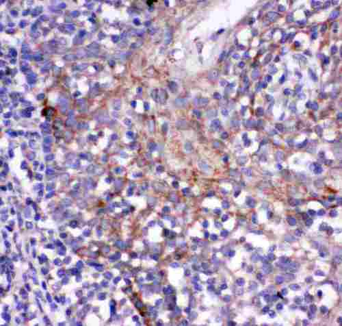 CD244 Antibody - anti-CD244 antibody, IHC(P): Human Tonsil Tissue