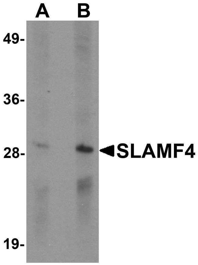 CD244 Antibody - Western blot analysis of SLAMF4 in Daudi cell lysate with SLAMF4 antibody at (A) 1 and (B) 2 ug/ml.