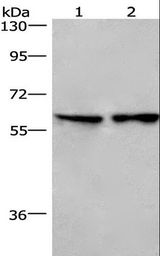 CD244 Antibody - Western blot analysis of Lovo cell and mouse lung tissue, using CD244 Polyclonal Antibody at dilution of 1:526.