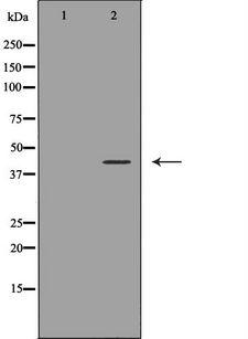 CD244 Antibody - Western blot analysis of Jurkat cells extracts using CD244 antibody. The lane on the left is treated with the antigen-specific peptide.