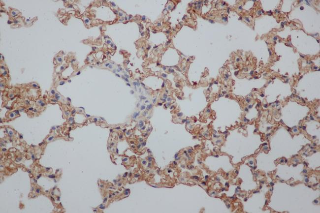 CD244 Antibody - Immunohistochemistry of paraffin-embedded Rat lung using CD244 Polyclonal Antibody at dilution of 1:50.