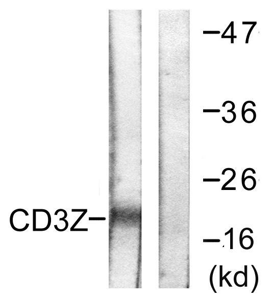 CD247 / CD3 Zeta Antibody - Western blot analysis of lysates from Jurkat cells, treated with UV 15', using CD3 zeta Antibody. The lane on the right is blocked with the synthesized peptide.