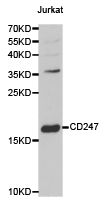 CD247 / CD3 Zeta Antibody - Western blot of extracts of Jurkat cell line, using CD247 antibody.