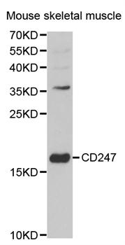 CD247 / CD3 Zeta Antibody - Western blot analysis of extracts of Jurkat cell lines.