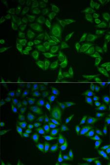 CD247 / CD3 Zeta Antibody - Immunofluorescence analysis of A549 cells.