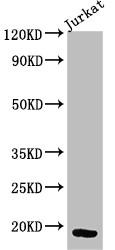 CD247 / CD3 Zeta Antibody - Positive WB detected in:Jurkat whole cell lysate;All lanes:CD247 antibody at 3?g/ml;Secondary;Goat polyclonal to rabbit IgG at 1/50000 dilution;Predicted band size: 19 KDa;Observed band size: 19 KDa;