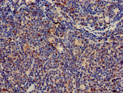 CD247 / CD3 Zeta Antibody - Immunohistochemistry of paraffin-embedded human lymph node tissue using CD247 Antibody at dilution of 1:100
