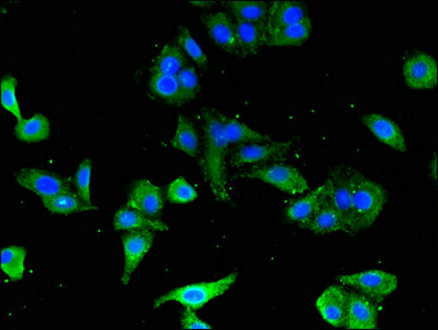 CD247 / CD3 Zeta Antibody - Immunofluorescent analysis of HepG2 cells using CD247 Antibody at dilution of 1:100 and Alexa Fluor 488-congugated AffiniPure Goat Anti-Rabbit IgG(H+L)