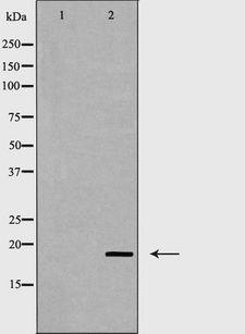 CD247 / CD3 Zeta Antibody - Western blot analysis of CD3 ? expression in Jurkat cells lysate. The lane on the left is treated with the antigen-specific peptide.