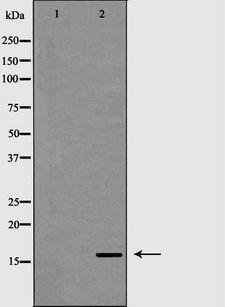 CD247 / CD3 Zeta Antibody - Western blot analysis of extracts of Jurkat cells using CD247 antibody. The lane on the left is treated with the antigen-specific peptide.