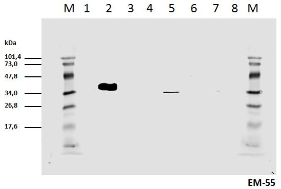CD247 / CD3 Zeta Antibody - Cell lyzates of HEK293T/17 cells transiently transfected  with expression vectors harboring genes for mCD3zeta wild type and six different mCD3zeta mutants, where particular ITAM tyrosines were substituted with phenylalanines, were prepared. Subsequently the lysates (non-reducing conditions) were immunoblotted with mouse mAb anti-pY111 mCD3zeta (clone EM-55).    1: Wt mCD3zeta pervanadate non-stimulated  2: Wt mCD3zeta pervanadate  stimulated  3: mut. mCD3zeta Y/F2-6  4: mut. mCD3zeta Y/F1 and 3-6  5: mut. mCD3zeta Y/F1-2 and 4-6 (thus only pY111 remains native)  6: mut. mCD3zeta Y/F1-3 and 5-6  7: mut. mCD3zeta Y/F1-4 and 6   8: mut. mCD3zeta Y/F1-5