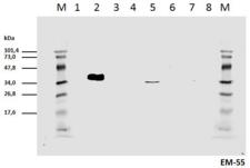 CD247 / CD3 Zeta Antibody - Cell lyzates of HEK293T/17 cells transiently transfected  with expression vectors harboring genes for mCD3zeta wild type and six different mCD3zeta mutants, where particular ITAM tyrosines were substituted with phenylalanines, were prepared. Subsequently the lysates (non-reducing conditions) were immunoblotted with mouse mAb anti-pY111 mCD3zeta (clone EM-55).    1: Wt mCD3zeta pervanadate non-stimulated  2: Wt mCD3zeta pervanadate  stimulated  3: mut. mCD3zeta Y/F2-6  4: mut. mCD3zeta Y/F1 and 3-6  5: mut. mCD3zeta Y/F1-2 and 4-6 (thus only pY111 remains native)  6: mut. mCD3zeta Y/F1-3 and 5-6  7: mut. mCD3zeta Y/F1-4 and 6   8: mut. mCD3zeta Y/F1-5