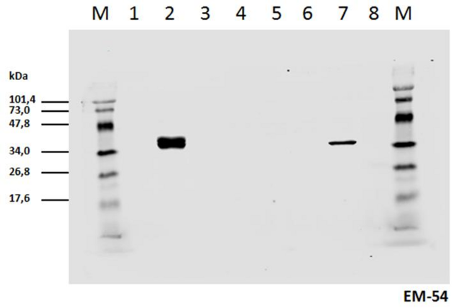CD247 / CD3 Zeta Antibody - Cell lyzates of HEK293T/17 cells transiently transfected  with expression vectors harboring genes for mCD3zeta wild type and six different mCD3zeta mutants, where particular ITAM tyrosines were substituted with phenylalanines, were prepared. Subsequently the lysates (non-reducing conditions) were immunoblotted with mouse mAb anti-pY142 mCD3zeta (clone EM-54).    1: Wt mCD3zeta pervanadate non-stimulated  2: Wt mCD3zeta pervanadate  stimulated  3: mut. mCD3zeta Y/F2-6  4: mut. mCD3zeta Y/F1 and 3-6  5: mut. mCD3zeta Y/F1-2 and 4-6  6: mut. mCD3zeta Y/F1-3 and 5-6  7: mut. mCD3zeta Y/F1-4 and 6 (thus only pY142 remains native)  8: mut. mCD3zeta Y/F1-5