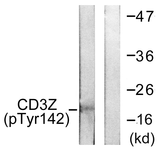 CD247 / CD3 Zeta Antibody - Western blot analysis of lysates from Jurkat cells treated with UV 15', using CD3 zeta (Phospho-Tyr142) Antibody. The lane on the right is blocked with the phospho peptide.