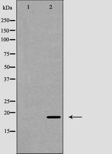 CD247 / CD3 Zeta Antibody - Western blot analysis of CD3 ? (Phospho-Tyr142) expression in Jurkat cells lysate. The lane on the left is treated with the antigen-specific peptide.