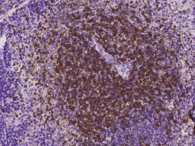 CD27 Antibody - Immunochemical staining of mouse CD27 in mouse spleen with rabbit monoclonal antibody at 1:200 dilution, formalin-fixed paraffin embedded sections.