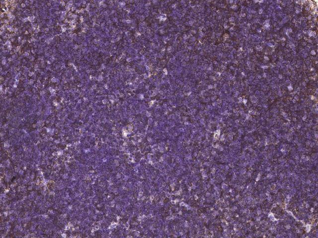 CD27 Antibody - Immunochemical staining of mouse CD27 in mouse thymus with rabbit monoclonal antibody at 1:200 dilution, formalin-fixed paraffin embedded sections.