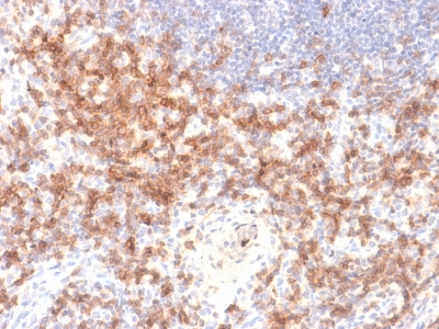 CD27 Antibody - Formalin-fixed, paraffin-embedded human Lymph Node stained with CD27 Rabbit Recombinant Monoclonal Antibody (LPFS2/2034R).