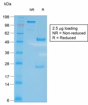 CD27 Antibody - SDS-PAGE Analysis of Purified CD27 Rabbit Recombinant Monoclonal Antibody (LPFS2/2034R). Confirmation of Purity and Integrity of Antibody.