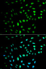 CD27 Antibody - Immunofluorescence analysis of MCF7 cells.