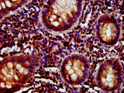 CD27 Antibody - IHC image of CD27 Antibody diluted at 1:800 and staining in paraffin-embedded human appendix tissue performed on a Leica BondTM system. After dewaxing and hydration, antigen retrieval was mediated by high pressure in a citrate buffer (pH 6.0). Section was blocked with 10% normal goat serum 30min at RT. Then primary antibody (1% BSA) was incubated at 4°C overnight. The primary is detected by a biotinylated secondary antibody and visualized using an HRP conjugated SP system.