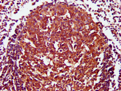 CD27 Antibody - IHC image of CD27 Antibody diluted at 1:800 and staining in paraffin-embedded human lymph node tissue performed on a Leica BondTM system. After dewaxing and hydration, antigen retrieval was mediated by high pressure in a citrate buffer (pH 6.0). Section was blocked with 10% normal goat serum 30min at RT. Then primary antibody (1% BSA) was incubated at 4°C overnight. The primary is detected by a biotinylated secondary antibody and visualized using an HRP conjugated SP system.