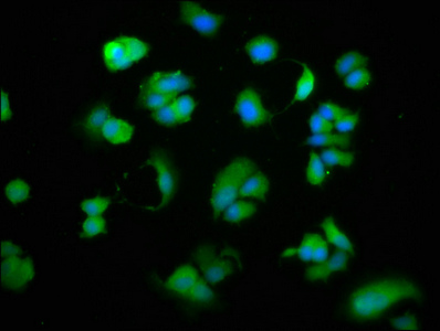 CD27 Antibody - Immunofluorescence staining of MCF-7 cells with CD27 Antibody at 1:266, counter-stained with DAPI. The cells were fixed in 4% formaldehyde, permeabilized using 0.2% Triton X-100 and blocked in 10% normal Goat Serum. The cells were then incubated with the antibody overnight at 4°C. The secondary antibody was Alexa Fluor 488-congugated AffiniPure Goat Anti-Rabbit IgG(H+L).