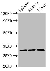 CD27 Antibody - Western Blot Positive WB detected in: Rat spleen tissue, Rat kidney tissue, Rat liver tissue All lanes: CD27 antibody at 3.2µg/ml Secondary Goat polyclonal to rabbit IgG at 1/50000 dilution Predicted band size: 30 kDa Observed band size: 30 kDa