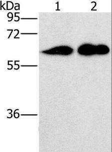 CD27 Antibody - Western blot analysis of Raji and LOVO cell, using CD27 Polyclonal Antibody at dilution of 1:701.